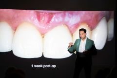 GOD25RecitaliaiBirstone-58